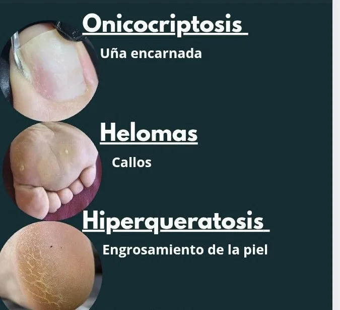 pedicura/podocosmiatria (desde)